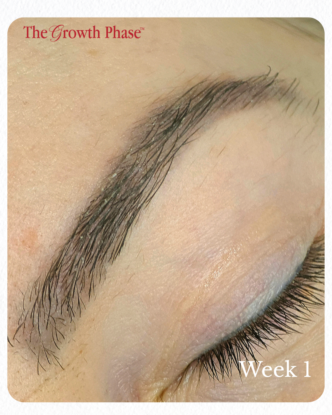 brow regeneration before photo week 1 The Growth Phase