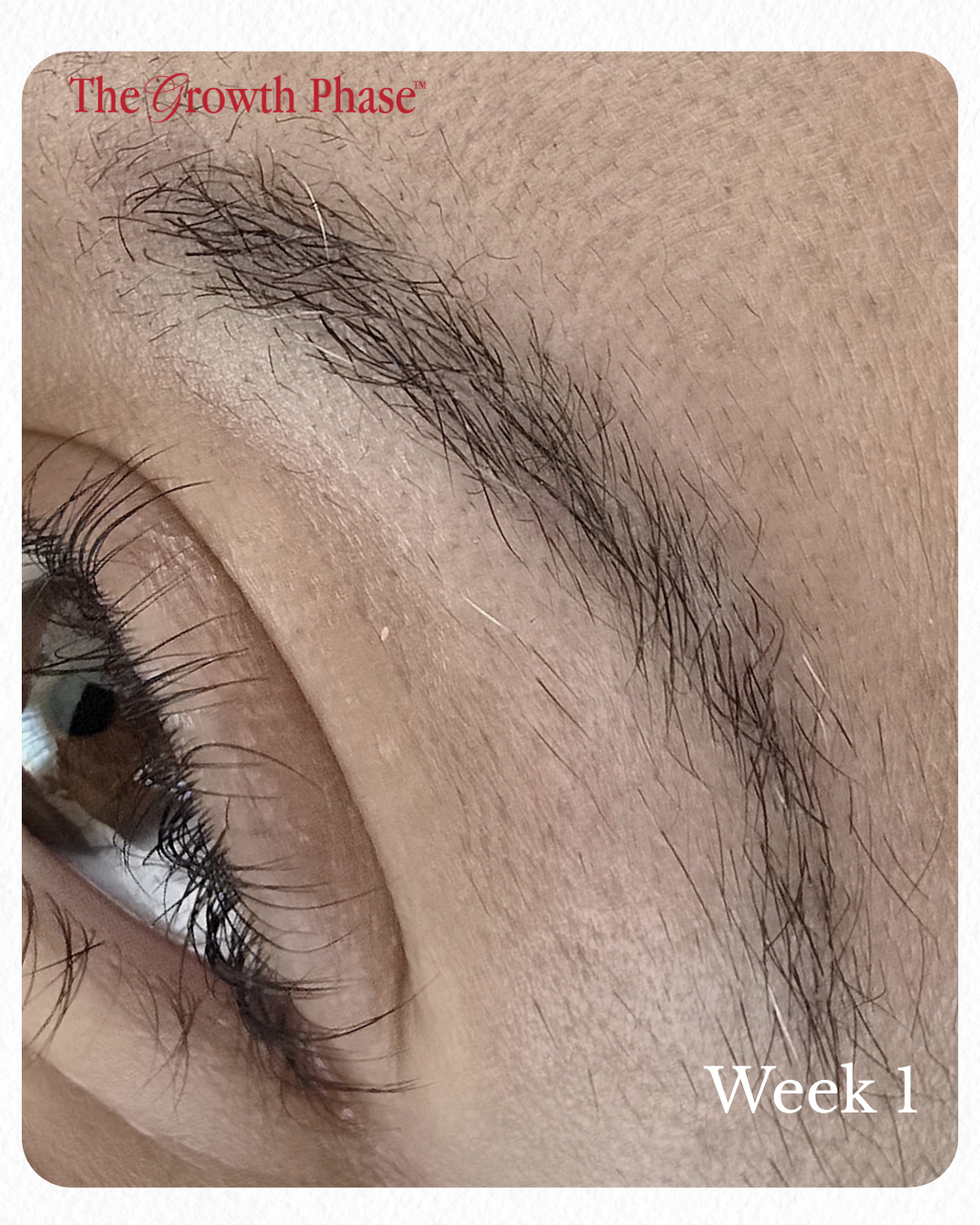 thinning brow before and after The Growth Phase brow regeneration
