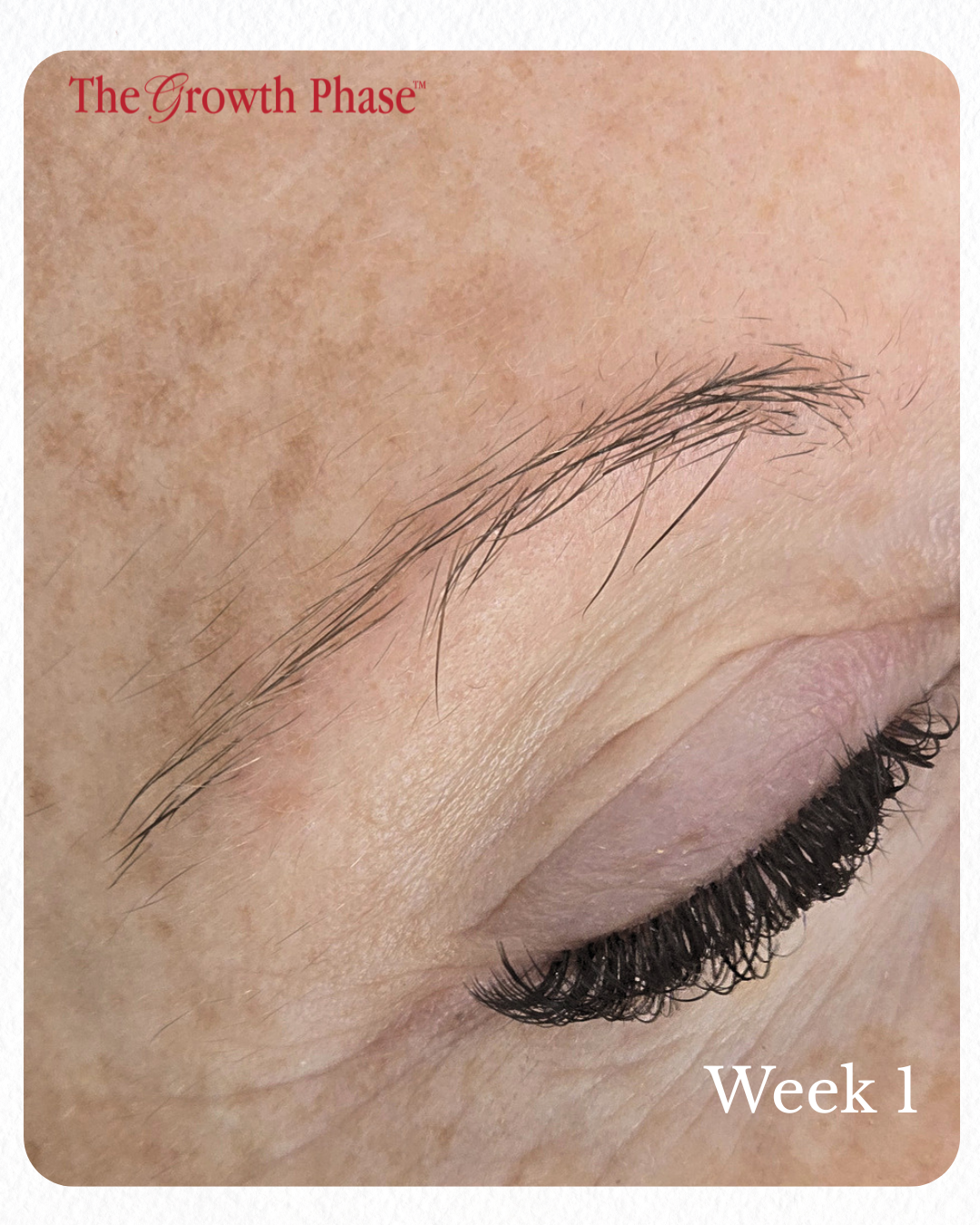 brow regeneration program Australia real results The Growth Phase