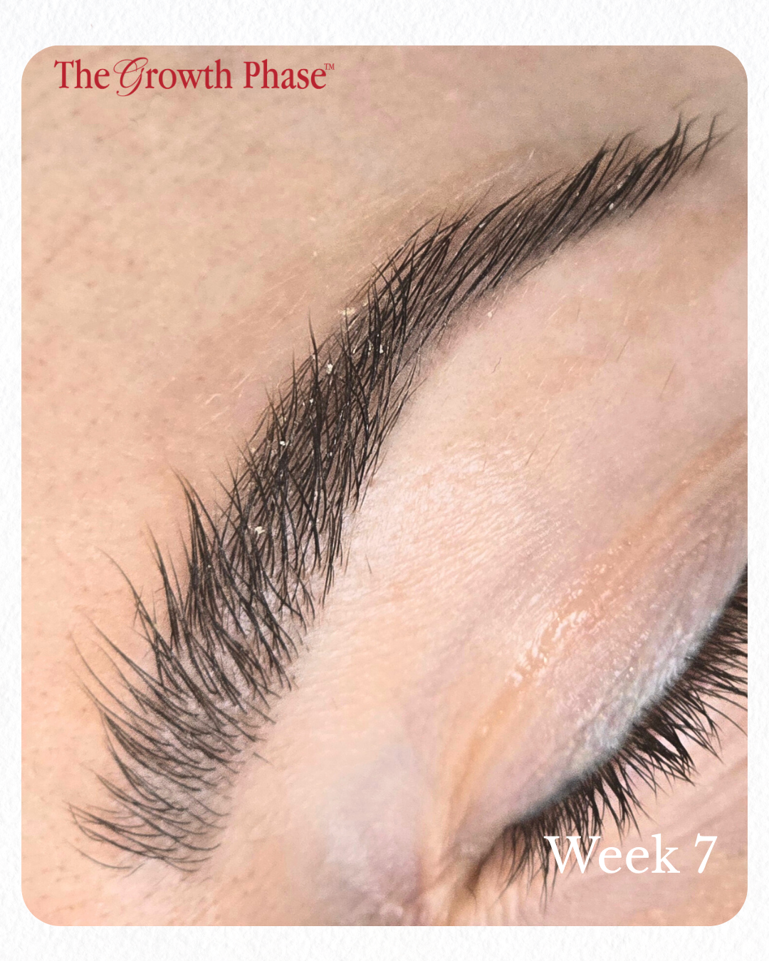 brow regeneration before and after week 1 to week 10 The Growth Phase Williamstown