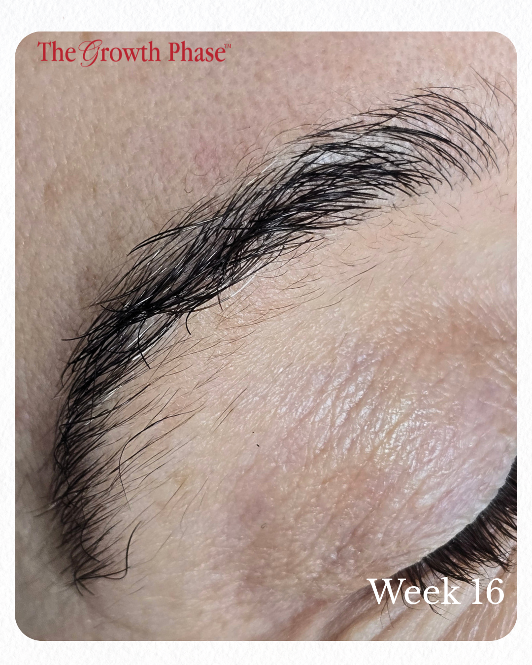 follicle regeneration eyebrow result real client The Growth Phase Melbourne