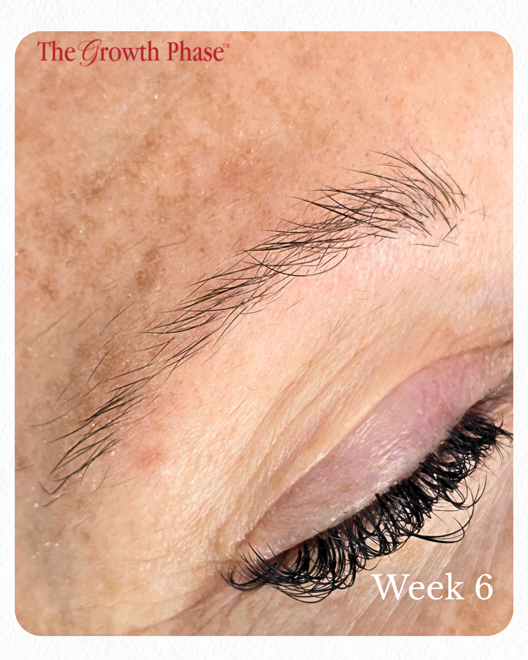 eyebrow growth serum result before and after The Growth Phase