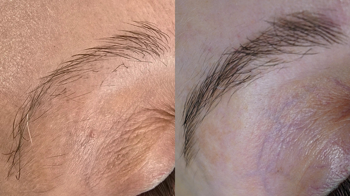 Why Your Brows Grow Unevenly And What the Hair Growth Cycle Is Really Telling You
