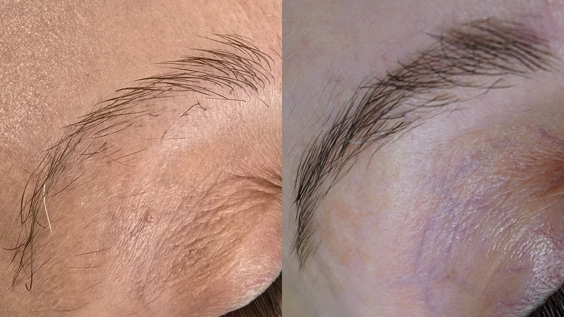Why Your Brows Grow Unevenly — And What the Hair Growth Cycle Is Really Telling You