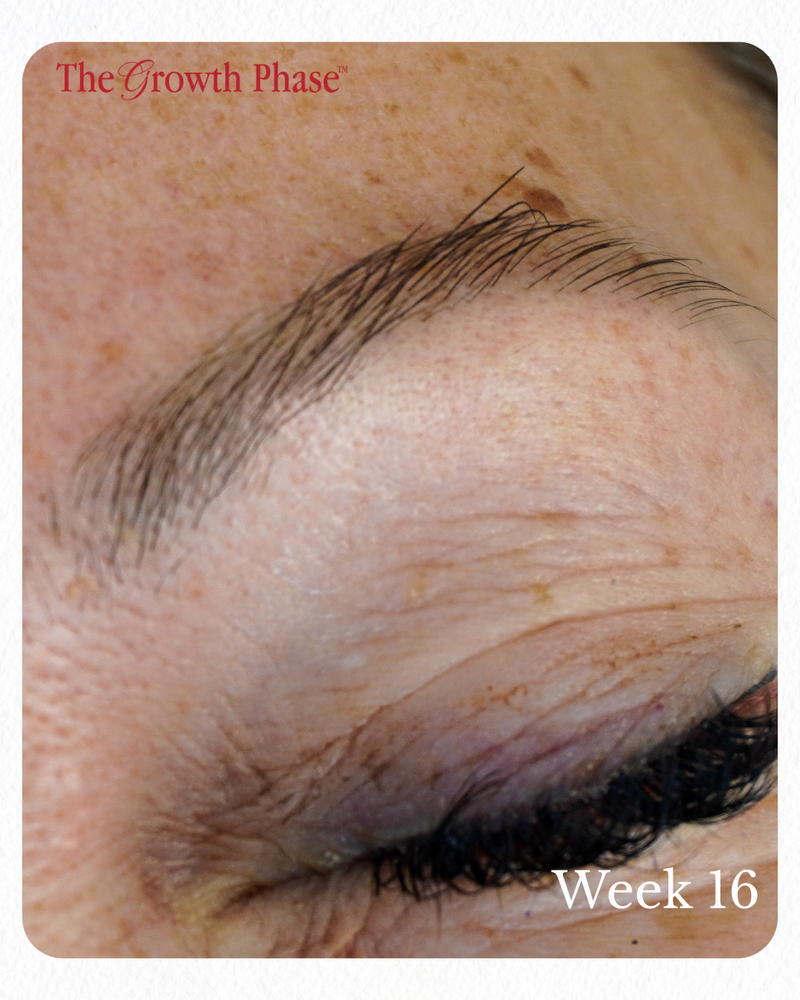 over plucked eyebrow regrowth before and after The Growth Phase