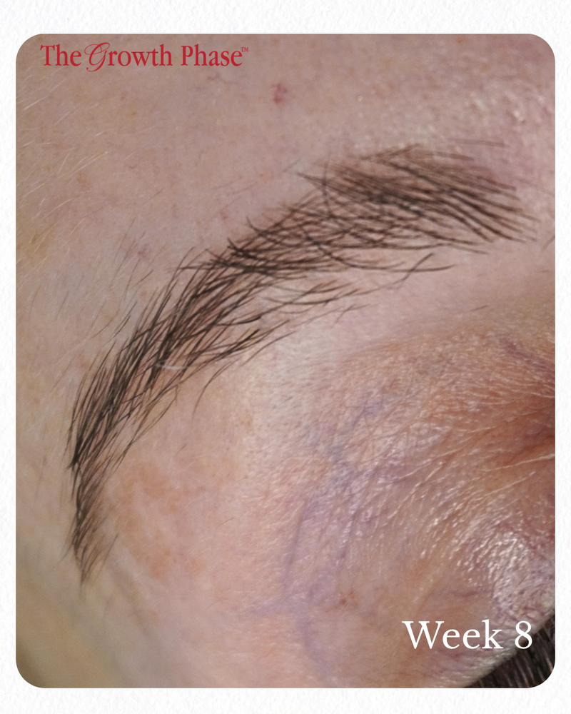 eyebrow density improvement 12 week brow regeneration program