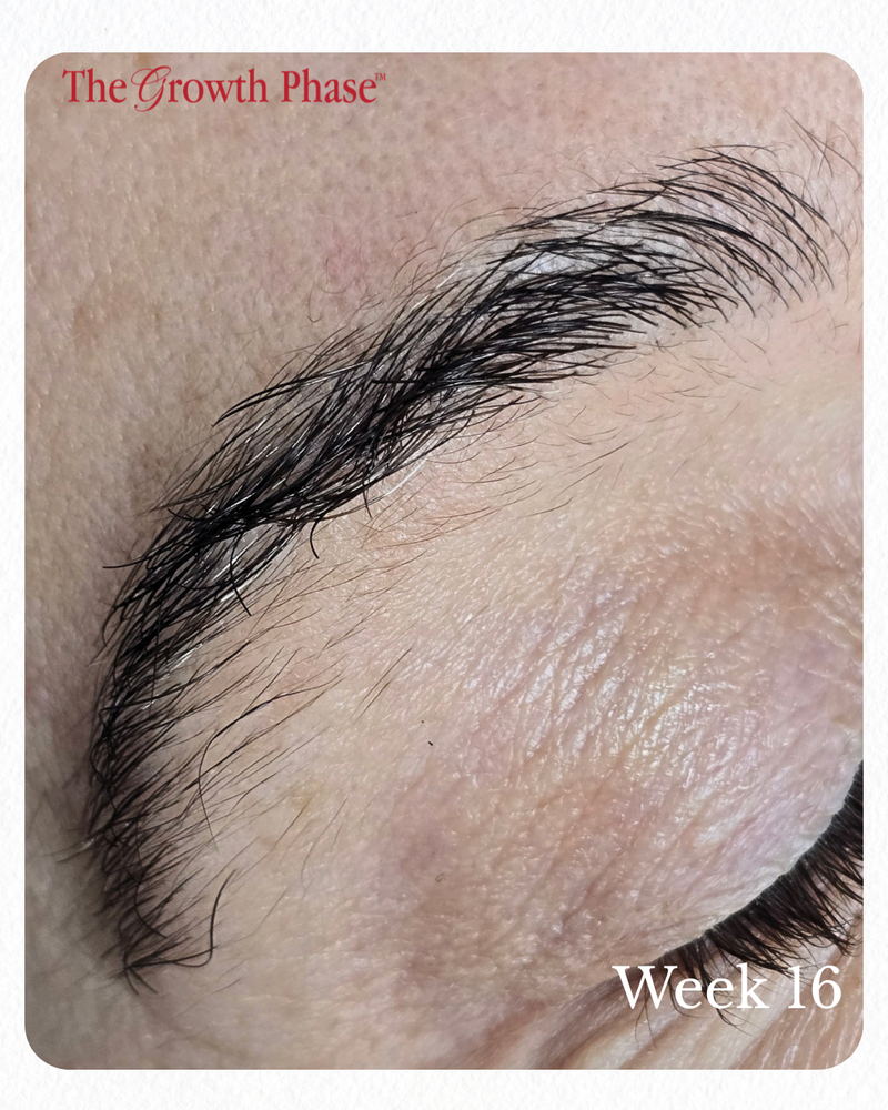 follicle regeneration eyebrow result real client The Growth Phase Melbourne
