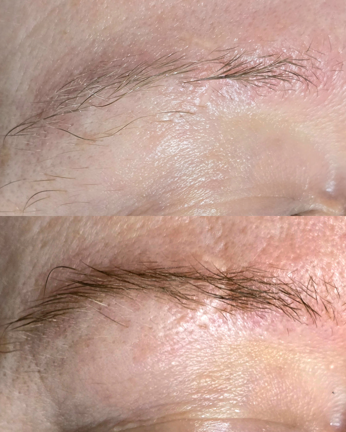 The Growth Phase™ Brow Restoration Kit