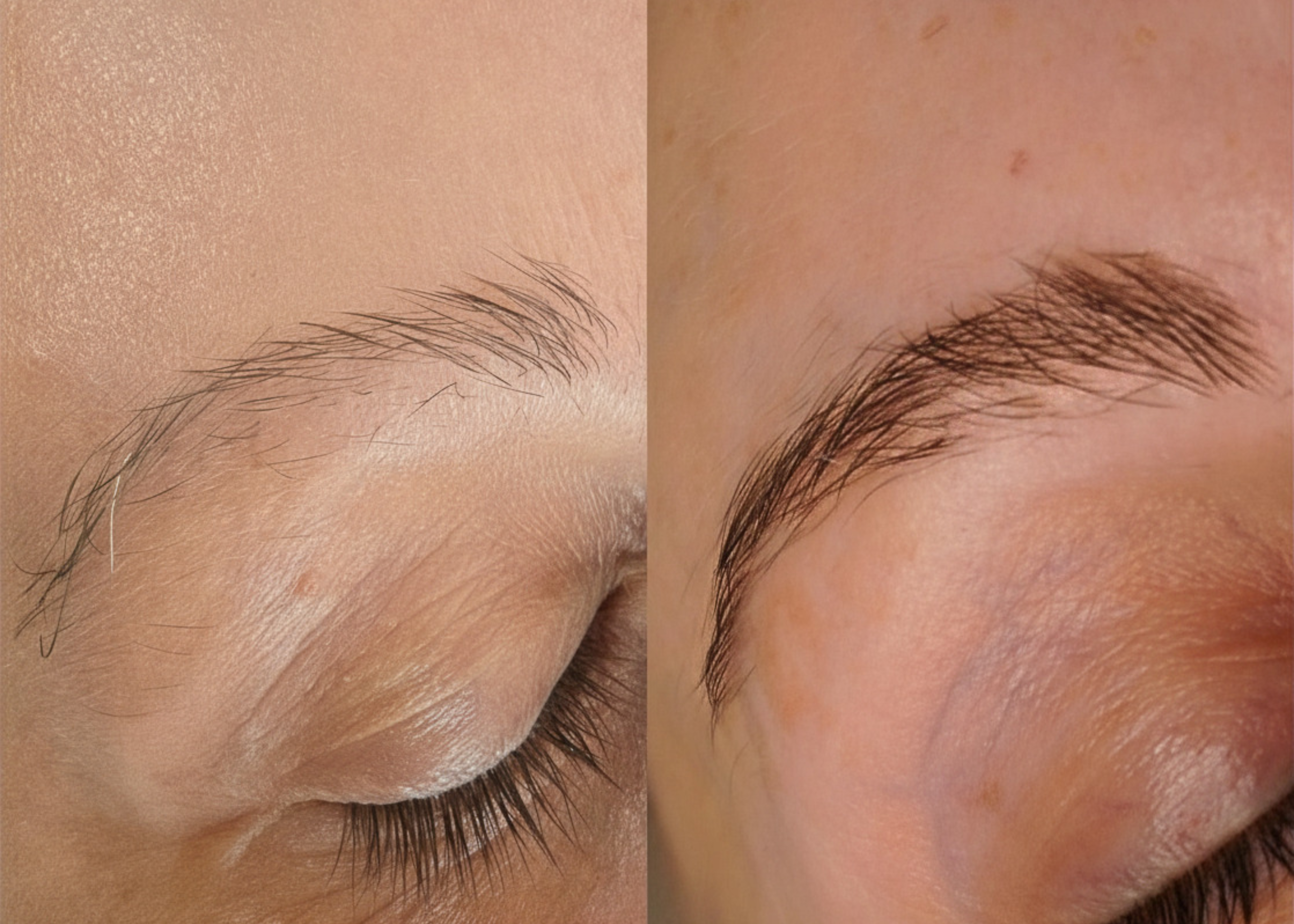 The Growth Phase™ 12–16 Week Brow Regeneration Program